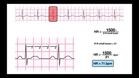 hr 150 check the box